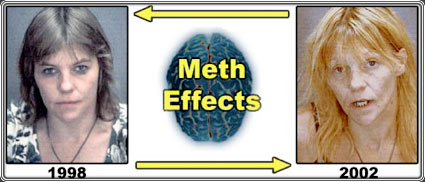 METH MUG SHOTE BEFORE AND AFTER Pictures...